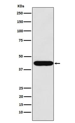 LHX2 Antibody (SR1750), Novus Biologicals 50 &mu;g; Unconjugated:Antibodies,