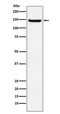 Jagged 2 Antibody (SR1166), Novus Biologicals:Anticorps:Anticorps primaires