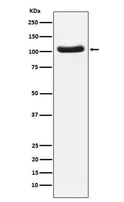PDE2A Antibody (SR1040), Novus Biologicals:Antibodies:Primary Antibodies