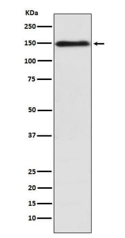 COL11A1 Antibody (SR1191), Novus Biologicals:Antibodies:Primary Antibodies