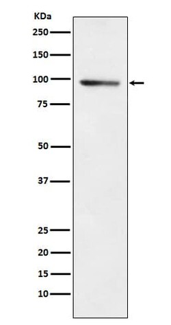 PDE4B Antibody (SR2301), Novus Biologicals 100 &mu;g | Buy Online | Novus Biologicals | Fisher Scientific