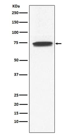 Guanylyl Cyclase alpha 1 Antibody (SR2180), Novus Biologicals 100 &mu;g;