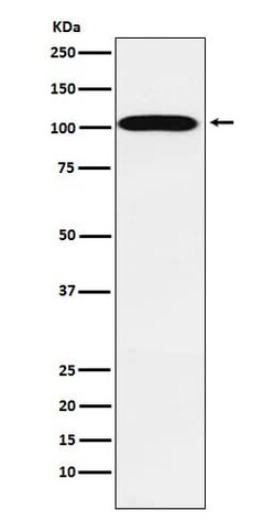 Sodium Potassium ATPase Alpha 2 Antibody (SR1026), Novus Biologicals:Antibodies:Primary