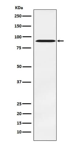 ATRIP Antibody (SR2262), Novus Biologicals 50 &mu;g; Unconjugated:Antibodies,