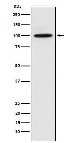 CTNNA3 Antibody (SR1012), Novus Biologicals 100 &mu;g; Unconjugated:Antibodies,