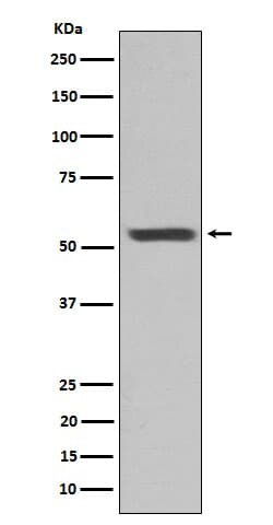 Cytokeratin 12 Antibody (SR1957), Novus Biologicals:Antibodies:Primary