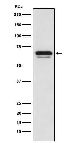p66 alpha Antibody (SR2093), Novus Biologicals 100 &mu;g; Unconjugated:Antibodies,