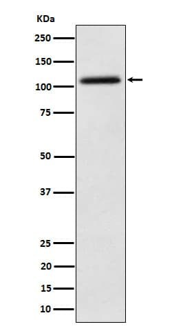 NAT10 Antibody (SR1073), Novus Biologicals 100 &mu;g; Unconjugated:Antibodies,
