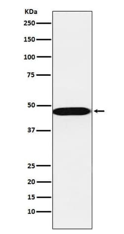 Adenosylhomocysteinase/AHCY Antibody (SR1809), Novus Biologicals:Antibodies:Primary