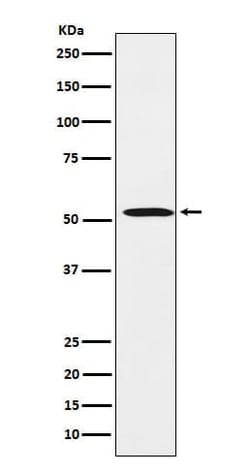 FADS1 Antibody (SR1912), Novus Biologicals 100 μg; Unconjugated:Antibodies,
