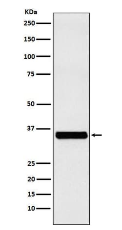 Exosome component 7 Antibody (SR1528), Novus Biologicals 50 &mu;g | Buy Online | Novus Biologicals | Fisher Scientific