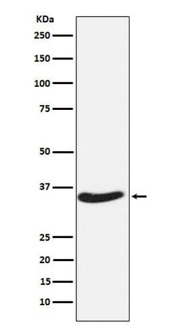 Exosome component 7 Antibody (SR1527), Novus Biologicals 50 &mu;g; Unconjugated:Antibodies,
