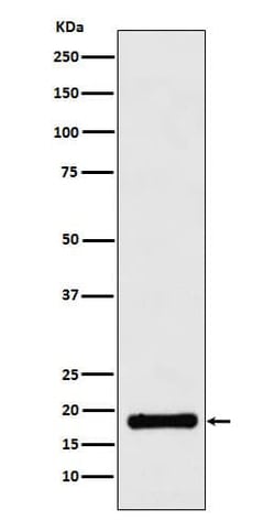 HR6B/UBE2B Antibody (SR1269), Novus Biologicals 50 &mu;g; Unconjugated:Antibodies,