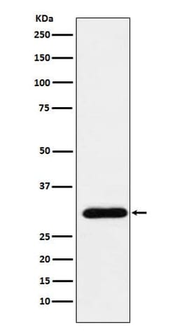 RAP30 Antibody (SR1503), Novus Biologicals:Antibodies:Primary Antibodies