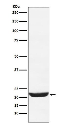 Frequenin Antibody (SR1350), Novus Biologicals 100 &mu;g | Buy Online | Novus Biologicals | Fisher Scientific