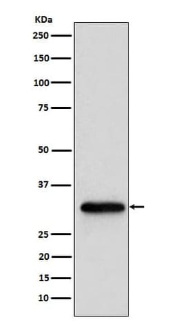 ADP-Sugar Pyrophosphatase/NUDT5 Antibody (SR1511), Novus Biologicals:Antibodies:Primary