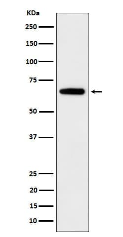 IMP2/IGF2BP2 Antibody (SR2110), Novus Biologicals 100 &mu;g; Unconjugated:Antibodies,