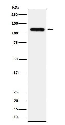 UBE4A Antibody (SR1103), Novus Biologicals 100 &mu;g; Unconjugated:Antibodies,