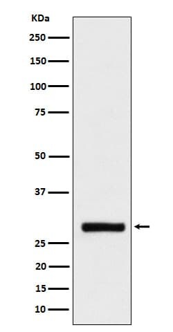BRMS1 Antibody (SR1460), Novus Biologicals:Antibodies:Primary Antibodies