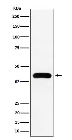 MVD Antibody (SR1738), Novus Biologicals:Antibodies:Primary Antibodies