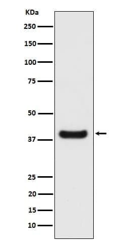 SPFH2 Antibody (SR1636), Novus Biologicals 100 &mu;g; Unconjugated:Antibodies,