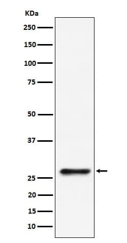 Ribosome maturation protein SBDS Antibody (SR1491), Novus Biologicals:Antibodies:Primary
