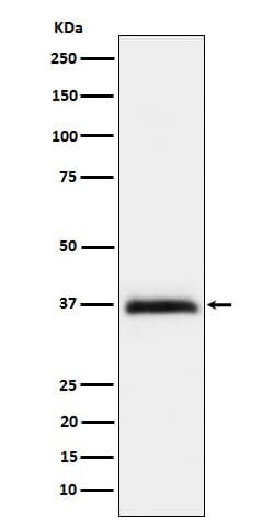 RGM-A Antibody (SR1626), Novus Biologicals 100 &mu;g, Unconjugated:Antibodies,