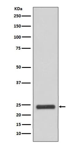 MRRF Antibody (SR1378), Novus Biologicals 100 &mu;g, Unconjugated:Antibodies,