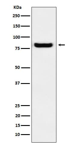 PRKCSH Antibody (SR2231), Novus Biologicals 100 &mu;g, Unconjugated:Antibodies,