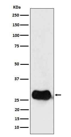 HLA DMB Antibody (SR1484), Novus Biologicals 50 &mu;g; Unconjugated:Antibodies,