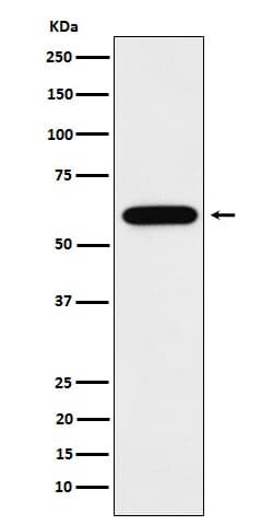 Tubby Antibody (SR2068), Novus Biologicals 100 &mu;g; Unconjugated:Antibodies,