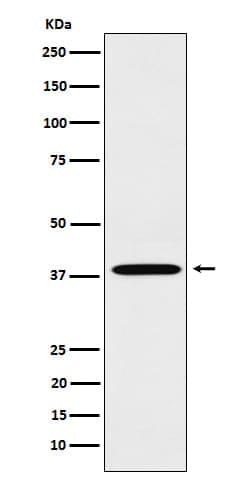 Leukotriene B4 R1 Antibody (SR1641), Novus Biologicals 50 &mu;g; Unconjugated:Antibodies,