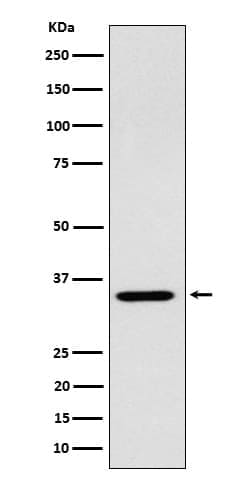 ARPC2 Antibody (SR1558), Novus Biologicals:Antibodies:Primary Antibodies
