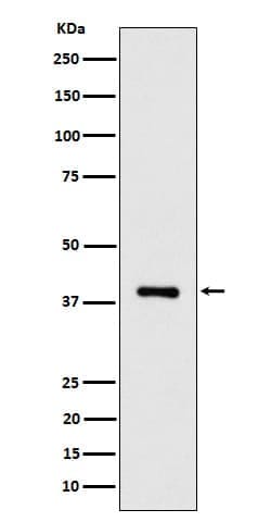 ACAT2 Antibody (SR1630), Novus Biologicals:Antibodies:Primary Antibodies