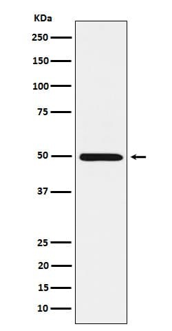 HGD Antibody (SR1835), Novus Biologicals:Antibodies:Primary Antibodies