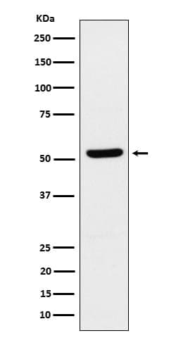 ZNF259 Antibody (SR1907), Novus Biologicals:Antibodies:Primary Antibodies