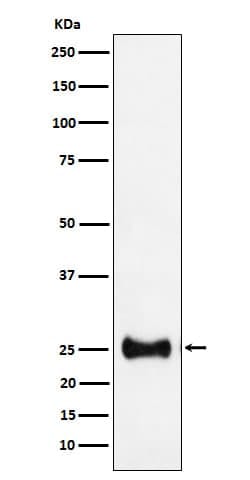 AK3L1 Antibody (SR1388), Novus Biologicals:Antibodies:Primary Antibodies