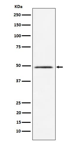 CLP1/HEAB Antibody (SR1834), Novus Biologicals:Antibodies:Primary Antibodies