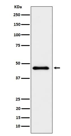 Elp4 Antibody (SR1794), Novus Biologicals 50 &mu;g; Unconjugated:Antibodies,