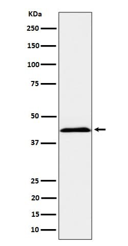 NKp44/NCR2 Antibody (SR1752), Novus Biologicals:Antibodies:Primary Antibodies