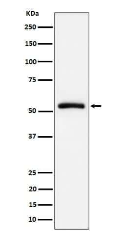 CAP1 Antibody (SR1982), Novus Biologicals 50 &mu;g; Unconjugated:Antibodies,