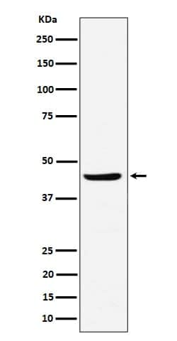 NDRG3 Antibody (SR1777), Novus Biologicals:Antibodies:Primary Antibodies