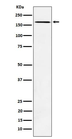 AGL Antibody (SR1250), Novus Biologicals:Antibodies:Primary Antibodies