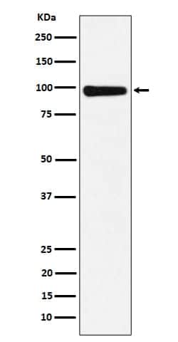 CHM Antibody (SR2298), Novus Biologicals 50 &mu;g; Unconjugated:Antibodies,