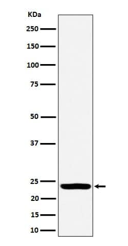 DTYMK Antibody (SR1364), Novus Biologicals 50 &mu;g; Unconjugated:Antibodies,