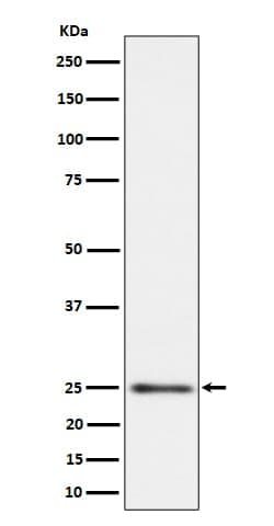 MRPS15 Antibody (SR1349), Novus Biologicals 100 &mu;g; Unconjugated:Antibodies,