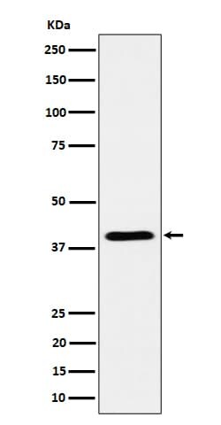alcohol dehydrogenase 4 Antibody (SR1609), Novus Biologicals 100 &mu;g;