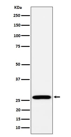 RPL13 Antibody (SR1422), Novus Biologicals 50 &mu;g; Unconjugated:Antibodies,
