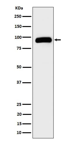 TRPV5 Antibody (SR2284), Novus Biologicals 100 &mu;g; Unconjugated:Antibodies,