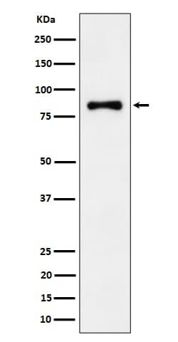 ALDH16A1 Antibody (SR2225), Novus Biologicals 100 &mu;g; Unconjugated:Anticuerpos